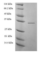 Recombinant Human 52KDA repressor of the inhibitor of the protein kinase (PRKRIR), partial – Figure 1 of 1