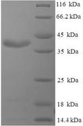 Recombinant Pig Prolactin (PRL) – Figure 1 of 1