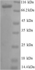 Recombinant Human Vitamin K-dependent protein S (PROS1) – Figure 1 of 1