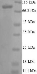 Recombinant Human Vitamin K-dependent protein S (PROS1) – Figure 1 of 1