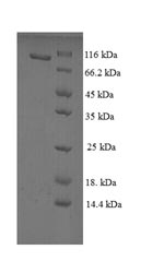 Recombinant Rat Vitamin K-dependent protein S (Pros1) – Figure 1 of 1