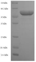 Recombinant Human Ribose-phosphate pyrophosphokinase 1 (PRPS1) – Figure 1 of 1