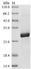 (Tris-Glycine gel) Discontinuous SDS-PAGE (reduced) with 5% enrichment gel and 15% separation gel.