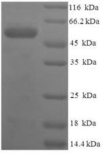 Recombinant Human Serine protease 23 (PRSS23) – Figure 1 of 1