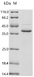 (Tris-Glycine gel) Discontinuous SDS-PAGE (reduced) with 5% enrichment gel and 15% separation gel.