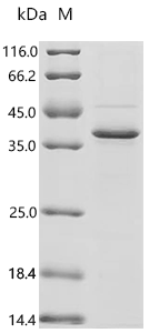 (Tris-Glycine gel) Discontinuous SDS-PAGE (reduced) with 5% enrichment gel and 15% separation gel.