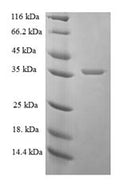 Recombinant Human Proactivator polypeptide (PSAP), partial – Figure 1 of 1