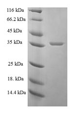 Recombinant Human Proactivator polypeptide (PSAP), partial – Figure 1 of 1