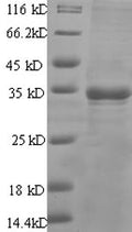 Recombinant Human Prostate stem cell antigen (PSCA) – Figure 1 of 1