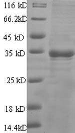 Recombinant Human Prostate stem cell antigen (PSCA) – Figure 1 of 1