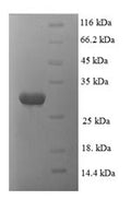 Recombinant Human Proteasome subunit alpha type-1 (PSMA1), partial – Figure 1 of 1