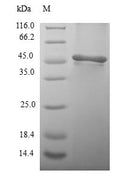 (Tris-Glycine gel) Discontinuous SDS-PAGE (reduced) with 5% enrichment gel and 15% separation gel.