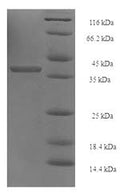 Recombinant Human 26S proteasome non-ATPase regulatory subunit 10 (PSMD10) – Figure 1 of 1