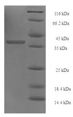 Recombinant Human 26S proteasome non-ATPase regulatory subunit 10 (PSMD10) – Figure 1 of 1