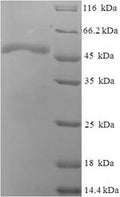 Recombinant Escherichia coli Phosphoserine phosphatase (serB) – Figure 1 of 1