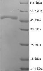 Recombinant Escherichia coli Phosphoserine phosphatase (serB) – Figure 1 of 1
