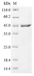 (Tris-Glycine gel) Discontinuous SDS-PAGE (reduced) with 5% enrichment gel and 15% separation gel.