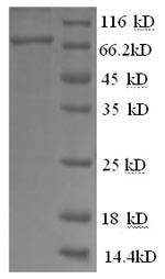 Recombinant Human Prostaglandin G/H synthase 2 (PTGS2), partial – Figure 1 of 1