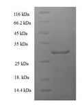Recombinant Human Parathyroid hormone 2 receptor (PTH2R), partial – Figure 1 of 1