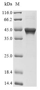 (Tris-Glycine gel) Discontinuous SDS-PAGE (reduced) with 5% enrichment gel and 15% separation gel.