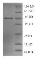 Recombinant Human Tyrosine-protein phosphatase non-receptor type 5 (PTPN5), partial – Figure 1 of 1