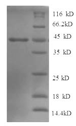Recombinant Human Tyrosine-protein phosphatase non-receptor type 5 (PTPN5), partial – Figure 1 of 1
