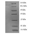 Recombinant Human Tyrosine-protein phosphatase non-receptor type 6 (PTPN6) – Figure 1 of 1
