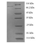 Recombinant Human Tyrosine-protein phosphatase non-receptor type 6 (PTPN6) – Figure 1 of 1