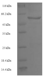 Recombinant Human Receptor-type tyrosine-protein phosphatase beta (PTPRB), partial – Figure 1 of 1