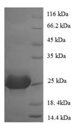 Recombinant Human Parvalbumin alpha (PVALB) – Figure 1 of 1