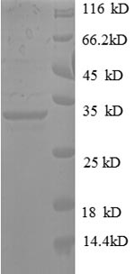 Recombinant Human t Pyrroline-5-carboxylate reductase 1, mitochondrial (PYCR1) – Figure 1 of 1