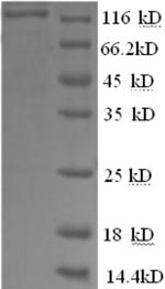 Recombinant Human Glycogen phosphorylase, liver form (PYGL), partial – Figure 1 of 1