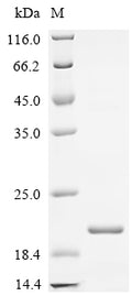 (Tris-Glycine gel) Discontinuous SDS-PAGE (reduced) with 5% enrichment gel and 15% separation gel.