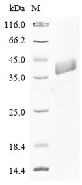 (Tris-Glycine gel) Discontinuous SDS-PAGE (reduced) with 5% enrichment gel and 15% separation gel.