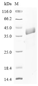 (Tris-Glycine gel) Discontinuous SDS-PAGE (reduced) with 5% enrichment gel and 15% separation gel.