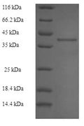Recombinant Human Ras-related protein Rab-27B (RAB27B) – Figure 1 of 1