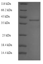 Recombinant Human Ras-related protein Rab-27B (RAB27B) – Figure 1 of 1