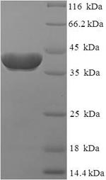 Recombinant Human Ras-related protein Rab-2A (RAB2A) – Figure 1 of 1