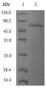 (Tris-Glycine gel) Discontinuous SDS-PAGE (reduced) with 5% enrichment gel and 15% separation gel.