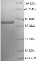 Recombinant Human Ras-related protein Rab-5A (RAB5A) – Figure 1 of 1
