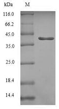 Recombinant Human Ras-related protein Rab-5C (RAB5C) – Figure 1 of 1