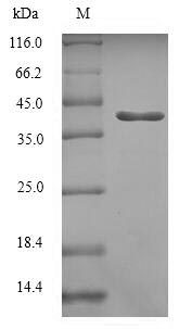Recombinant Human Ras-related protein Rab-5C (RAB5C) – Figure 1 of 1