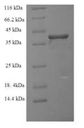 Recombinant Human Ras-related protein Rab-6A (RAB6A) – Figure 1 of 1