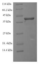 Recombinant Human Ras-related protein Rab-6A (RAB6A) – Figure 1 of 1
