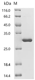 (Tris-Glycine gel) Discontinuous SDS-PAGE (reduced) with 5% enrichment gel and 15% separation gel.