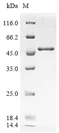 (Tris-Glycine gel) Discontinuous SDS-PAGE (reduced) with 5% enrichment gel and 15% separation gel.