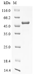 (Tris-Glycine gel) Discontinuous SDS-PAGE (reduced) with 5% enrichment gel and 15% separation gel.