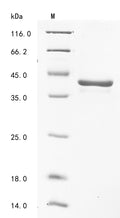 (Tris-Glycine gel) Discontinuous SDS-PAGE (reduced) with 5% enrichment gel and 15% separation gel.