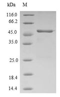 (Tris-Glycine gel) Discontinuous SDS-PAGE (reduced) with 5% enrichment gel and 15% separation gel.
