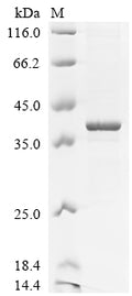 (Tris-Glycine gel) Discontinuous SDS-PAGE (reduced) with 5% enrichment gel and 15% separation gel.